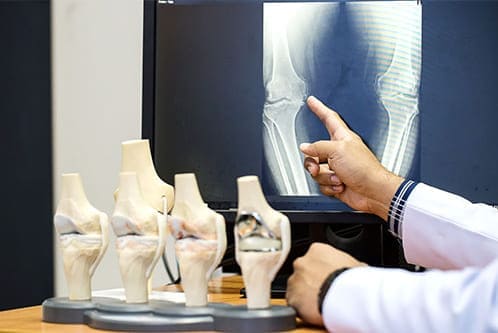 medicos ortopedistas
